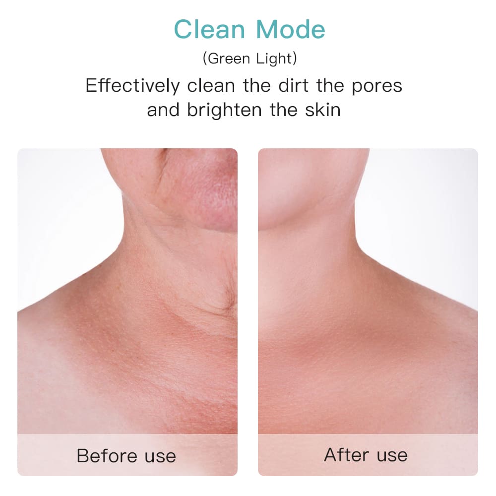 Ефективне очищення пор на обличчі або шиї до після